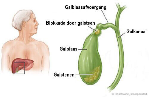 Heb jij wel eens last van één van deze symptomen? Dan kan het zijn dat