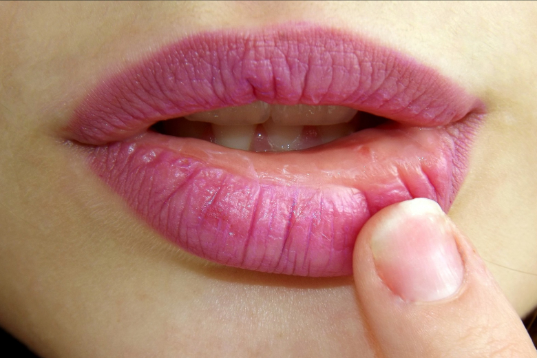 Zo ontstaan aften in je mond (en zo behandel je ze) Zo ontstaan aften in je mond (en zo behandel je ze)